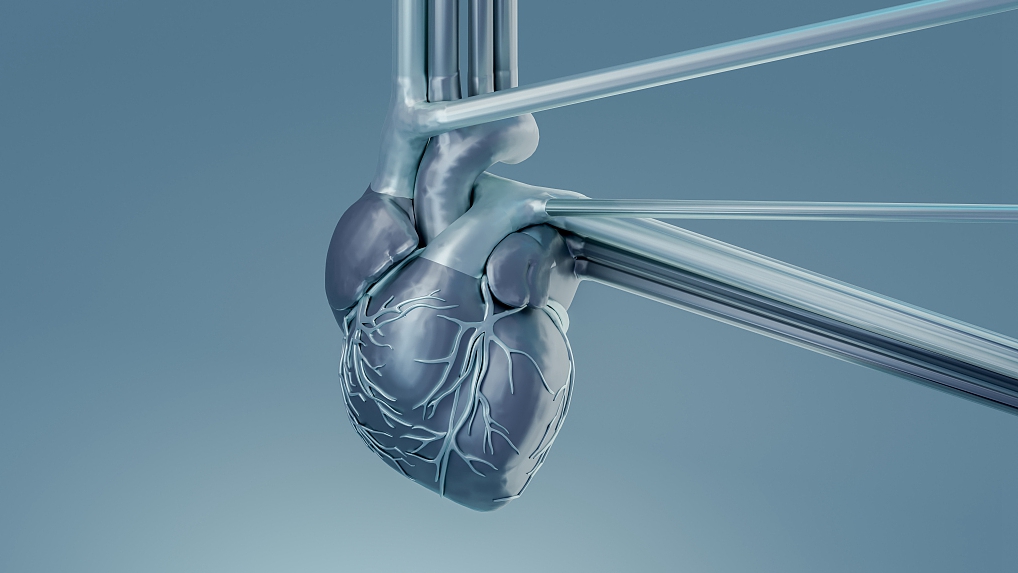 An illustration of an artificial heart. /CFP