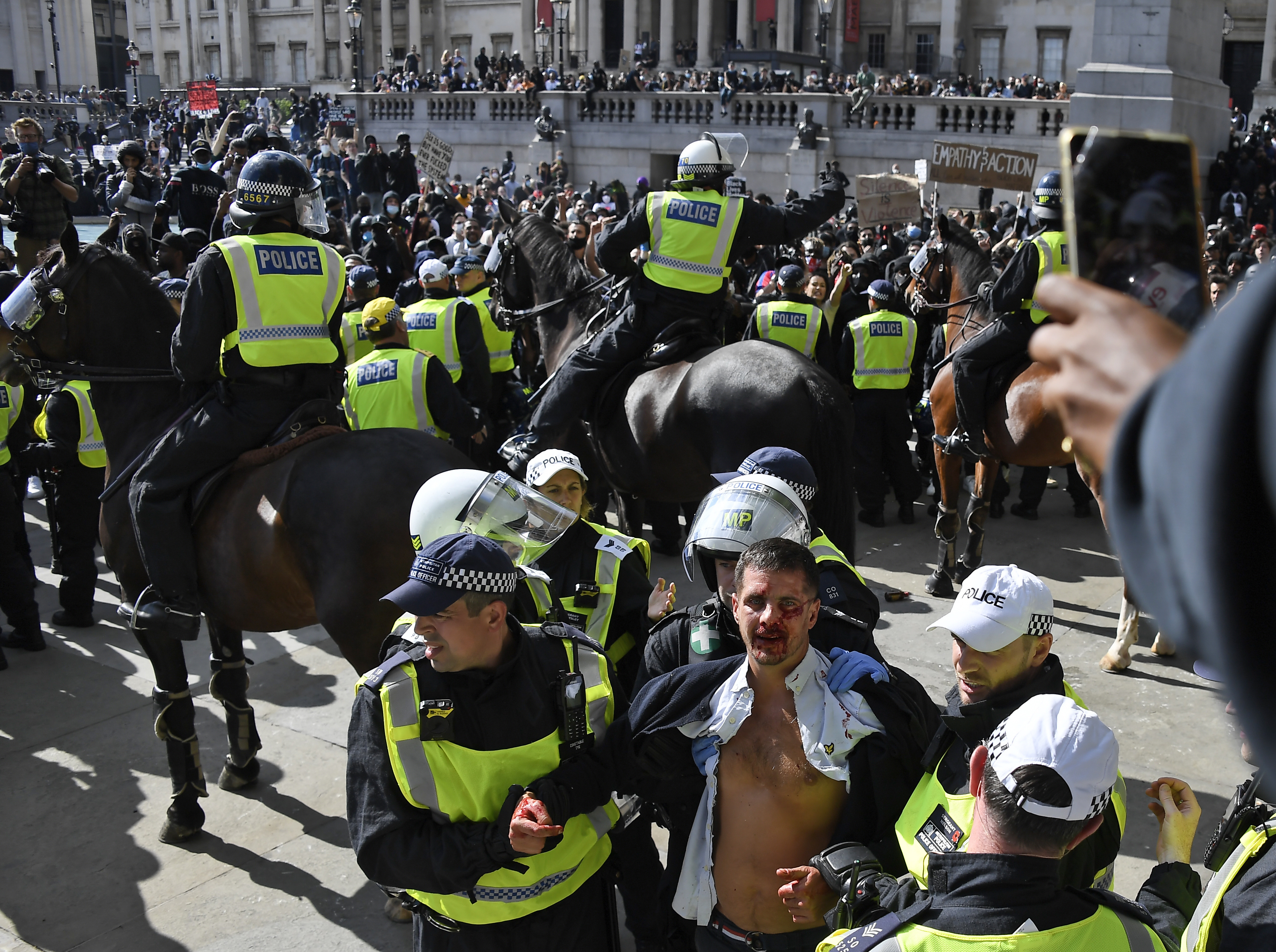 Over 100 arrests after violent clashes at farright linked UK protest