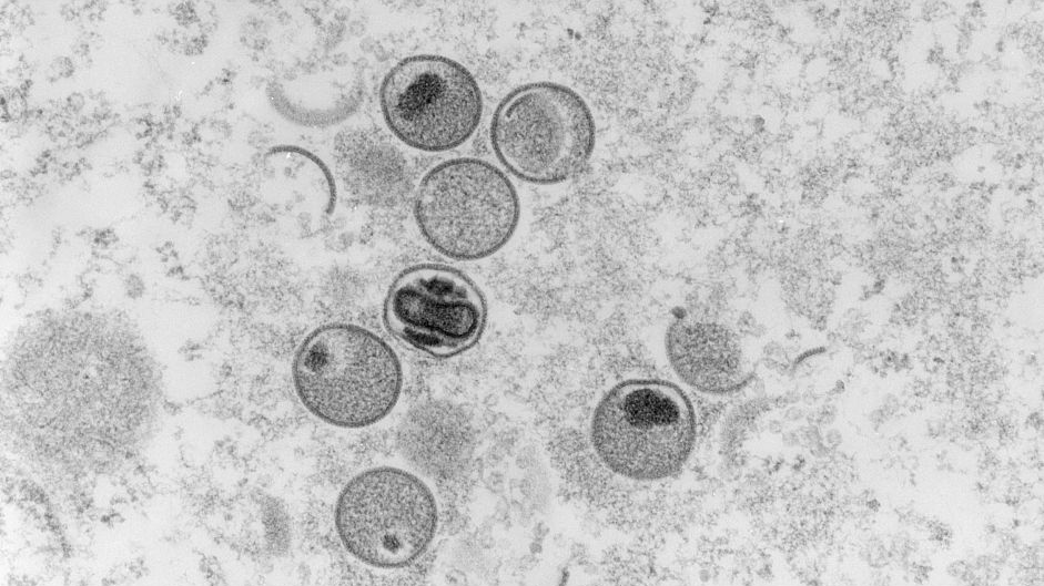An image taken in 2004 and released on May 23, 2022, shows the mpox virus under an ultramicrotomy for electron microscopy. /CFP