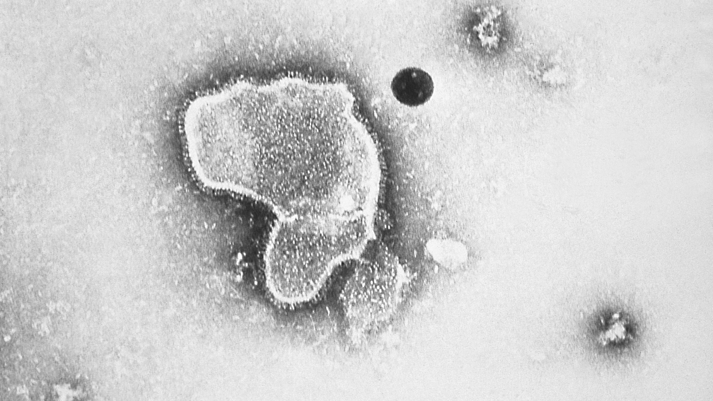 This 1981 electron microscope image shows a human respiratory syncytial virus, also known as RSV. /CFP