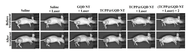 Deformable GQD NT used in photodynamic therapy. /IAPMST