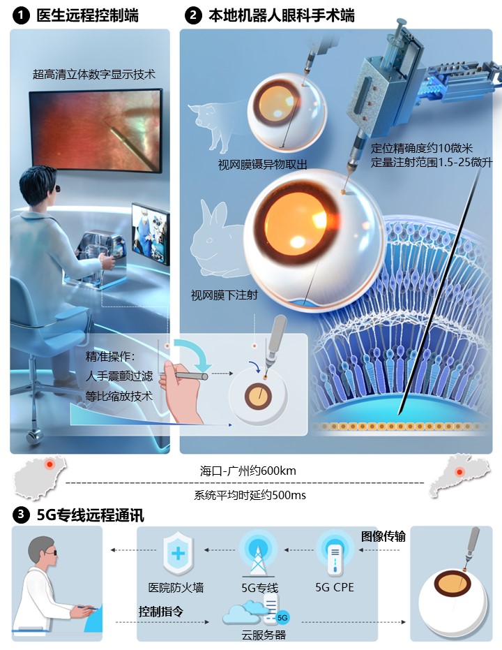 A schematic diagram of the 5G remote micron eye surgery robot. /China Science Daily