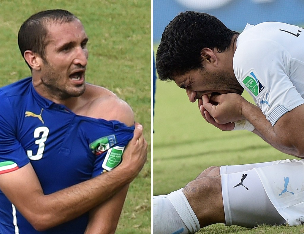 Giorgio Chiellini (L) of Italy pulls down his shirt to show tooth marks during his World Cup clash with Uruguay's Luis Suarez (R) at Estadio das Dunas in Natal, Brazil, June 24, 2014. /CFP