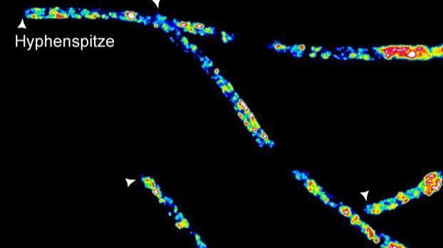 The loss of the RNA-binding protein Khd4 disrupts membrane trafficking. /Heinrich Heine University Duesseldorf