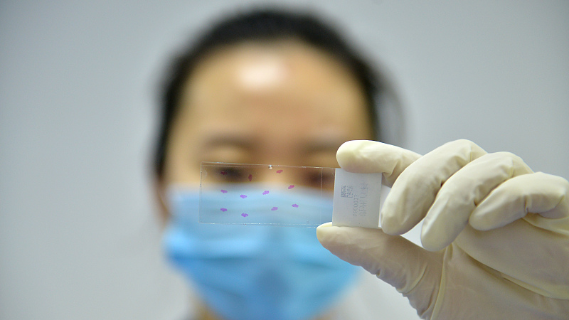 A researcher conducts genetic testing for cancer in the city of Guiyang in Guizhou Province, China, on January 4, 2017. /CFP 