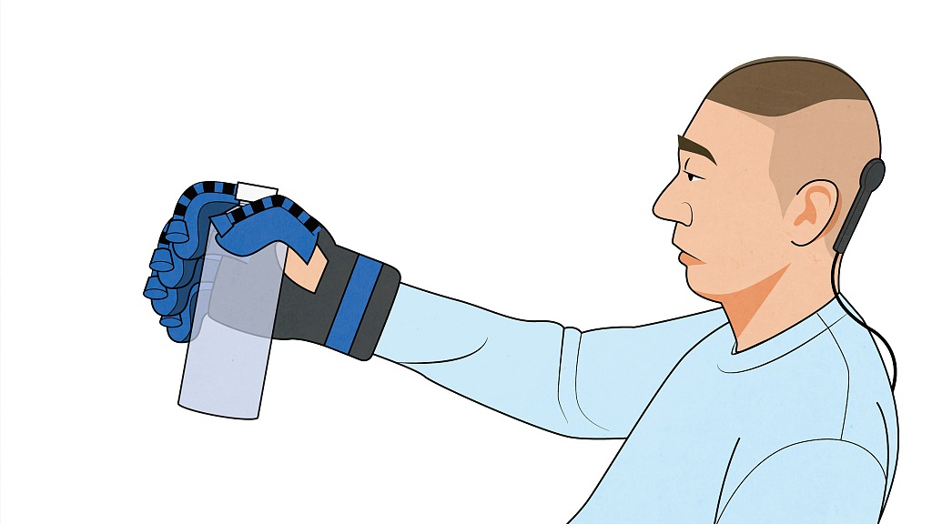 An illustration showing the patient with the implantable device NEO capable of fetching a bottle of water on his own via an air-filled glove driven by brain waves. /CFP