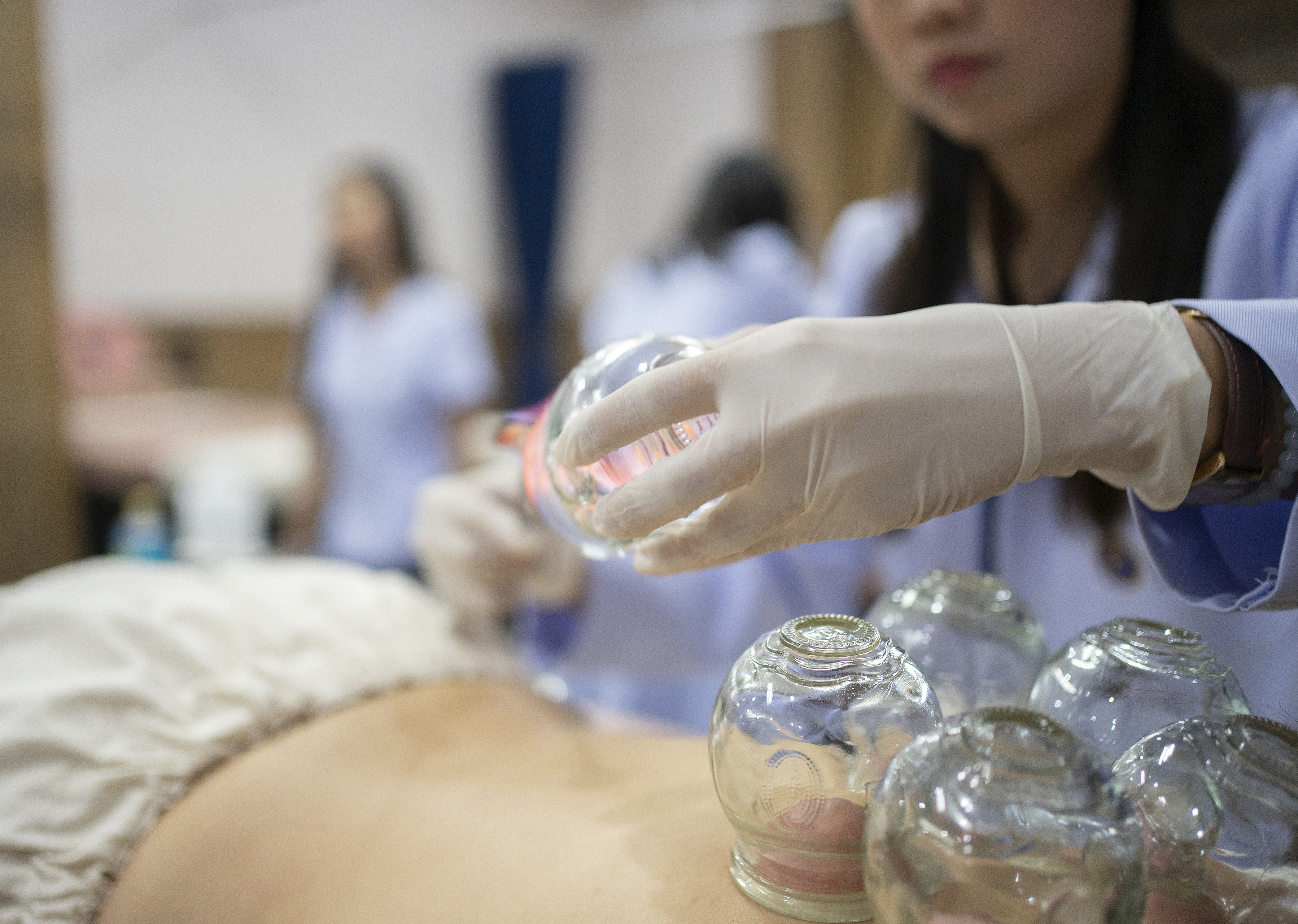 Cupping therapy in traditional Chinese medicine. /CFP