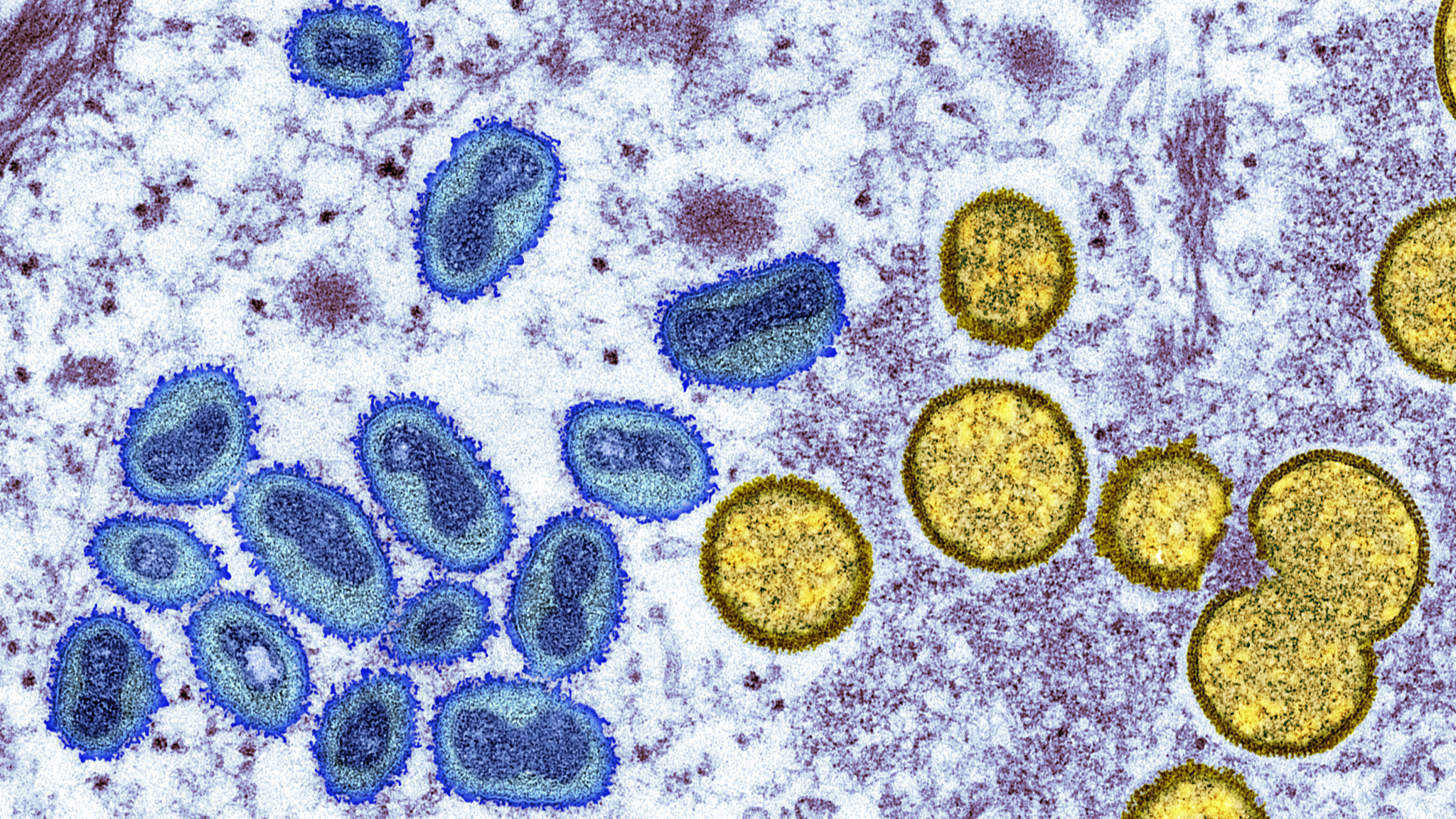 An illustration of mpox virus particles revealed by transmission electron microscopy. /CFP