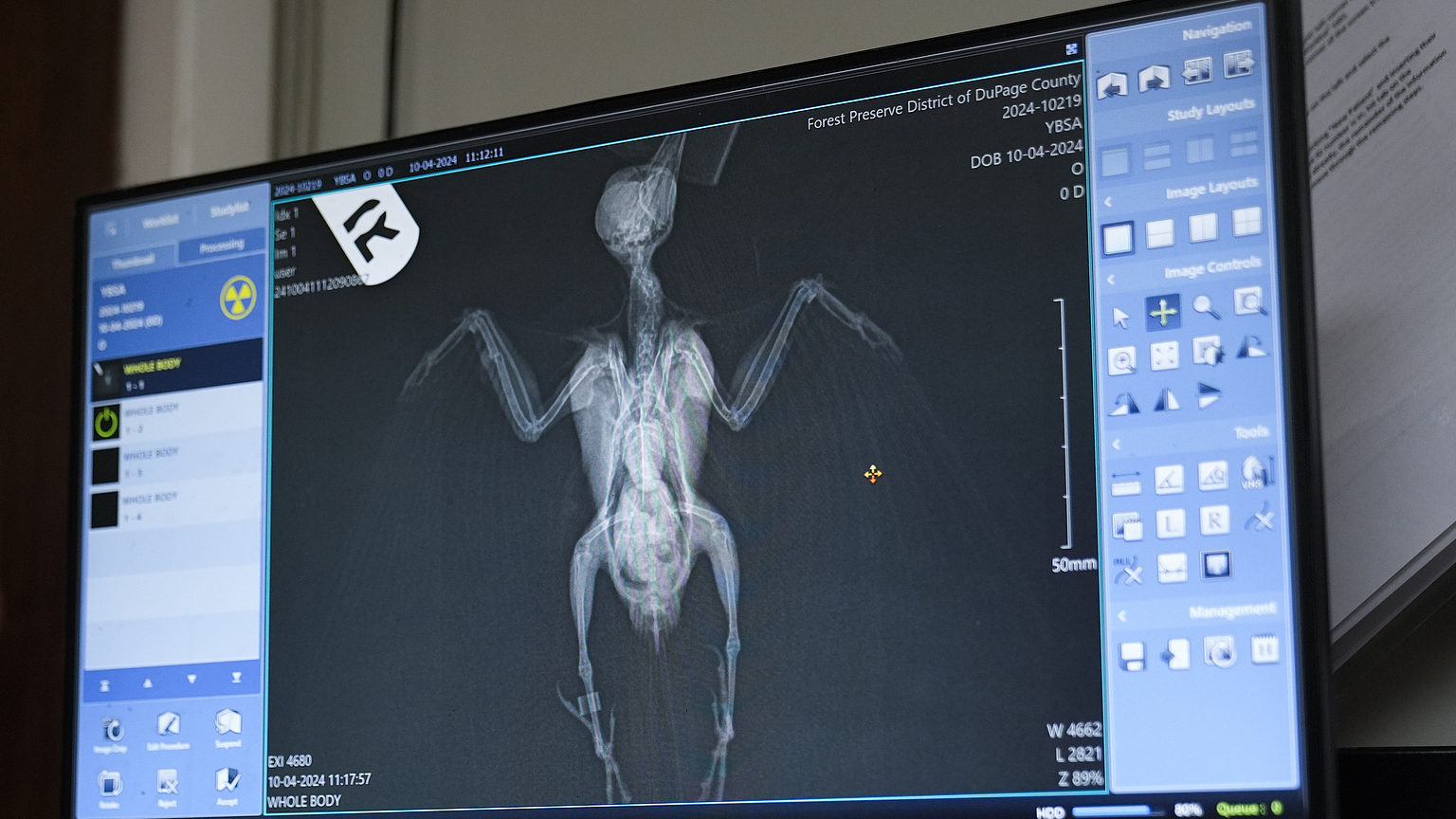 An x-ray of a yellow-bellied sapsucker at the DuPage Wildlife Conservation Center in Glen Ellyn, Illinois, October 4, 2024. /CFP