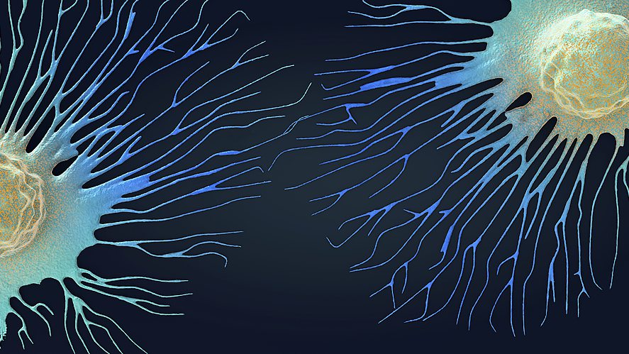 Illustration showing the spread of cancer cells. /CFP