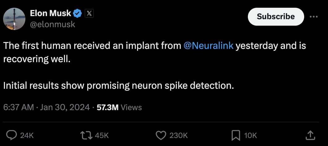 The first human patient receives Neuralink brain implant in January, 2024. /Screenshot from X