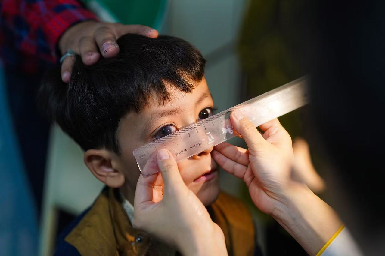 A photo taken in October 2024 in Bukhara, Uzbekistan, shows a seven-year-old boy was ready to receive a surgery covered by the 
