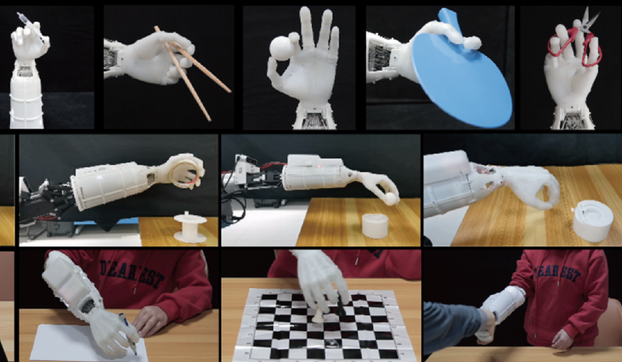 Groundbreaking Prosthetic Hand Developed by Chinese Research Team