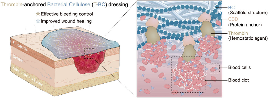 Application of T-BC dressing in wound therapy. /SIAT