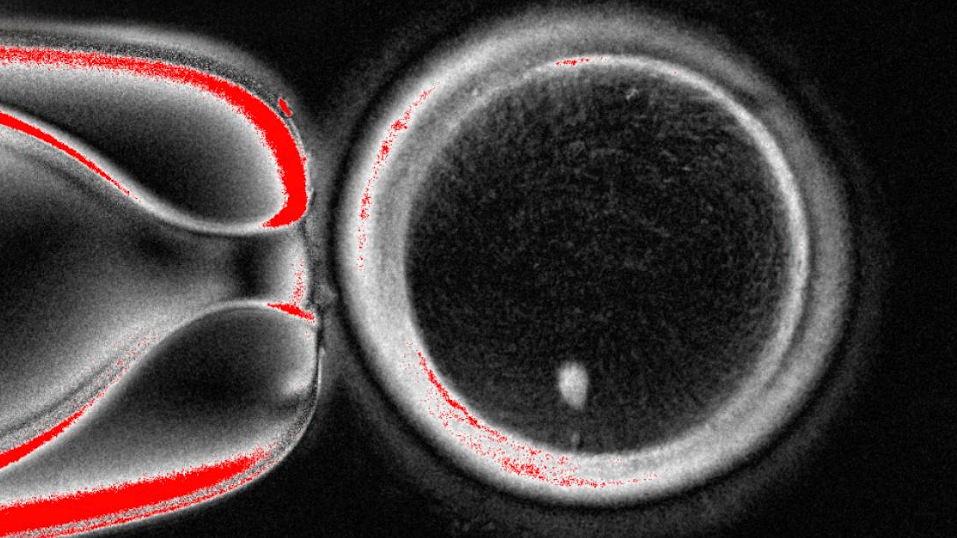 Scientists create human eggs using skin cells