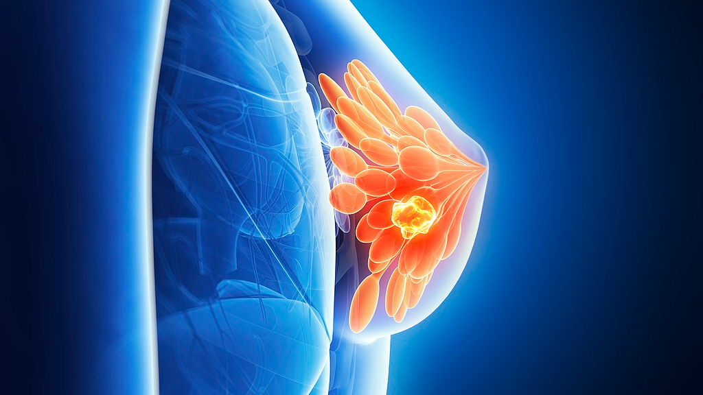 Australian study finds breastfeeding helps prevent breast cancer