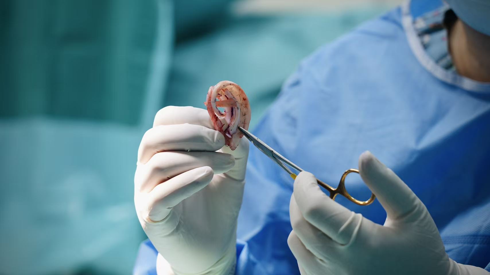 Professor Guo compares the carved ear scaffold with the 3D-printed model of a healthy ear during the sculpting process. /CGTN