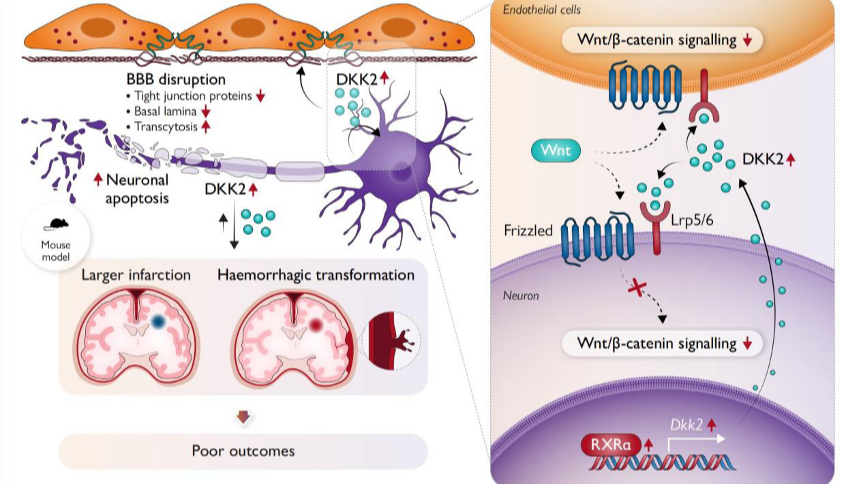 Chinese researchers identify instigator of neurovascular injury