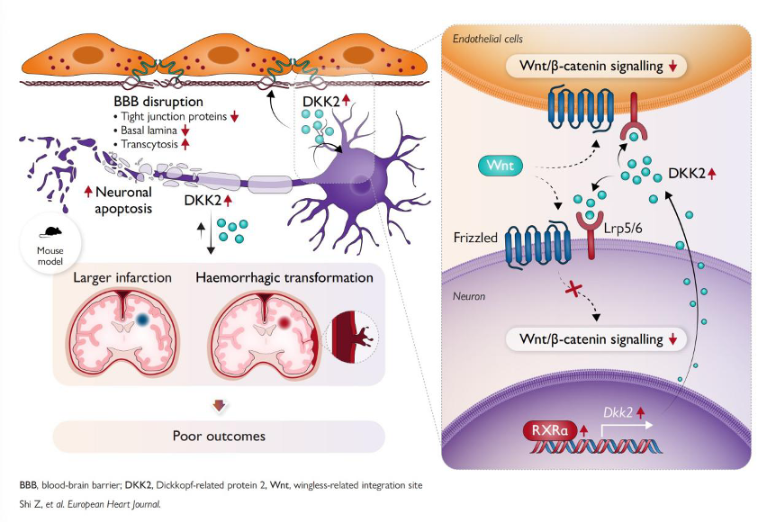 Graphical summary illustrating that neuronal DKK2 is robustly up-regulated following ischaemic stroke, suppressing canonical Wnt signaling and contributing to BBB disruption and neuronal death. /SIAT