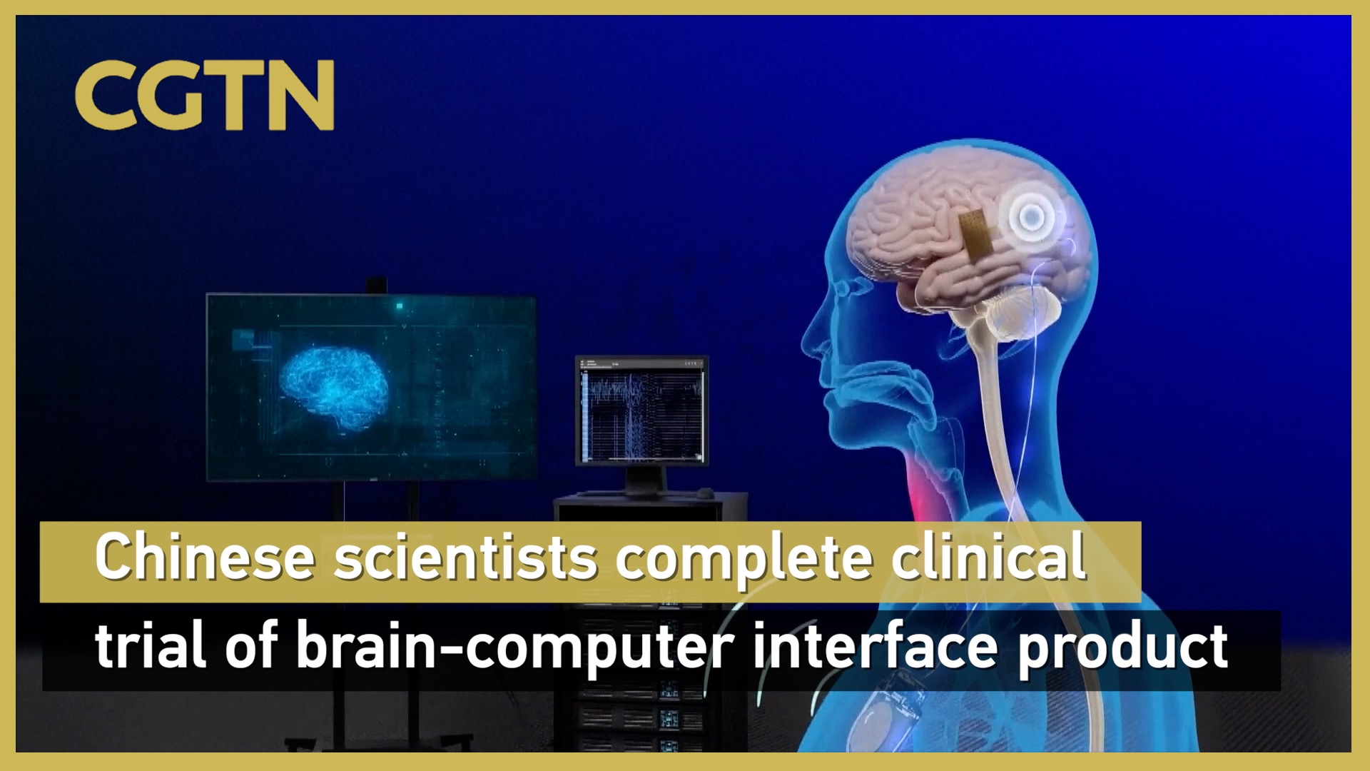 Chinese scientists complete clinical trial of brain-computer interface product