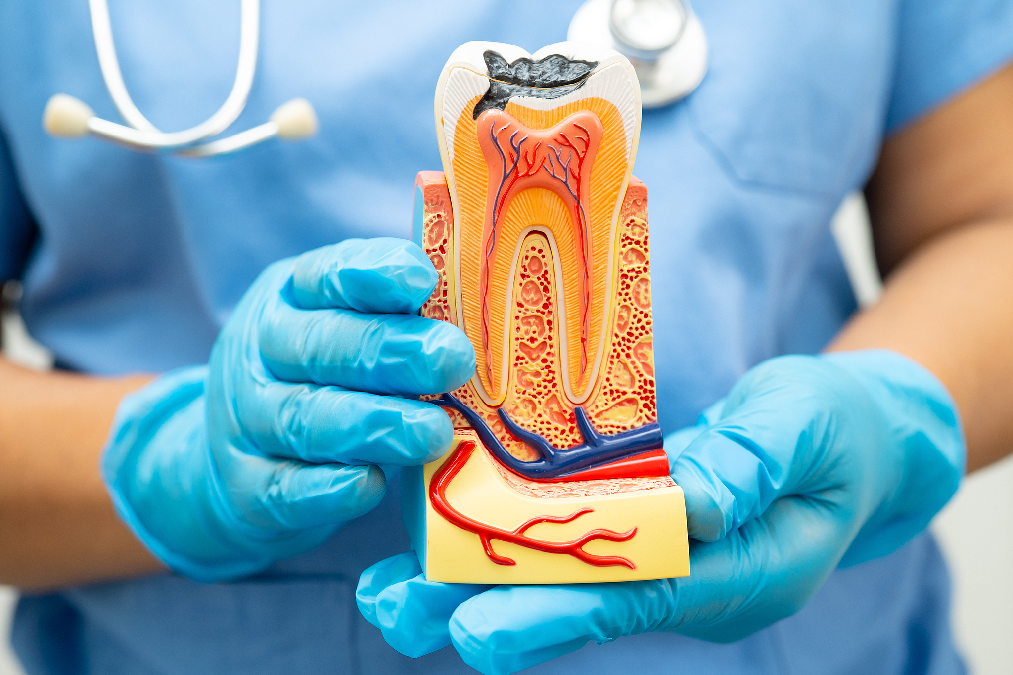 A dentist holds a dental model. /VCG
