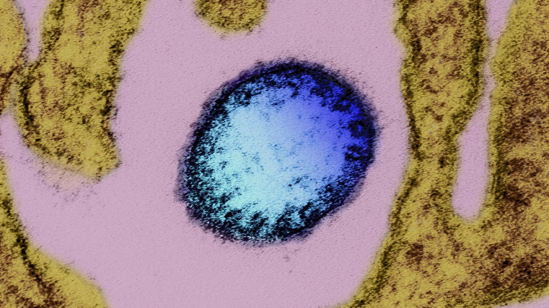 China says no Nipah virus cases but is ready to prevent it