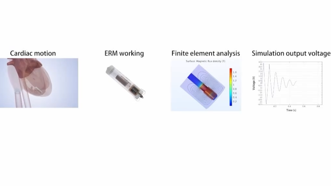 The workings of a cardiac pacemaker. /CMG