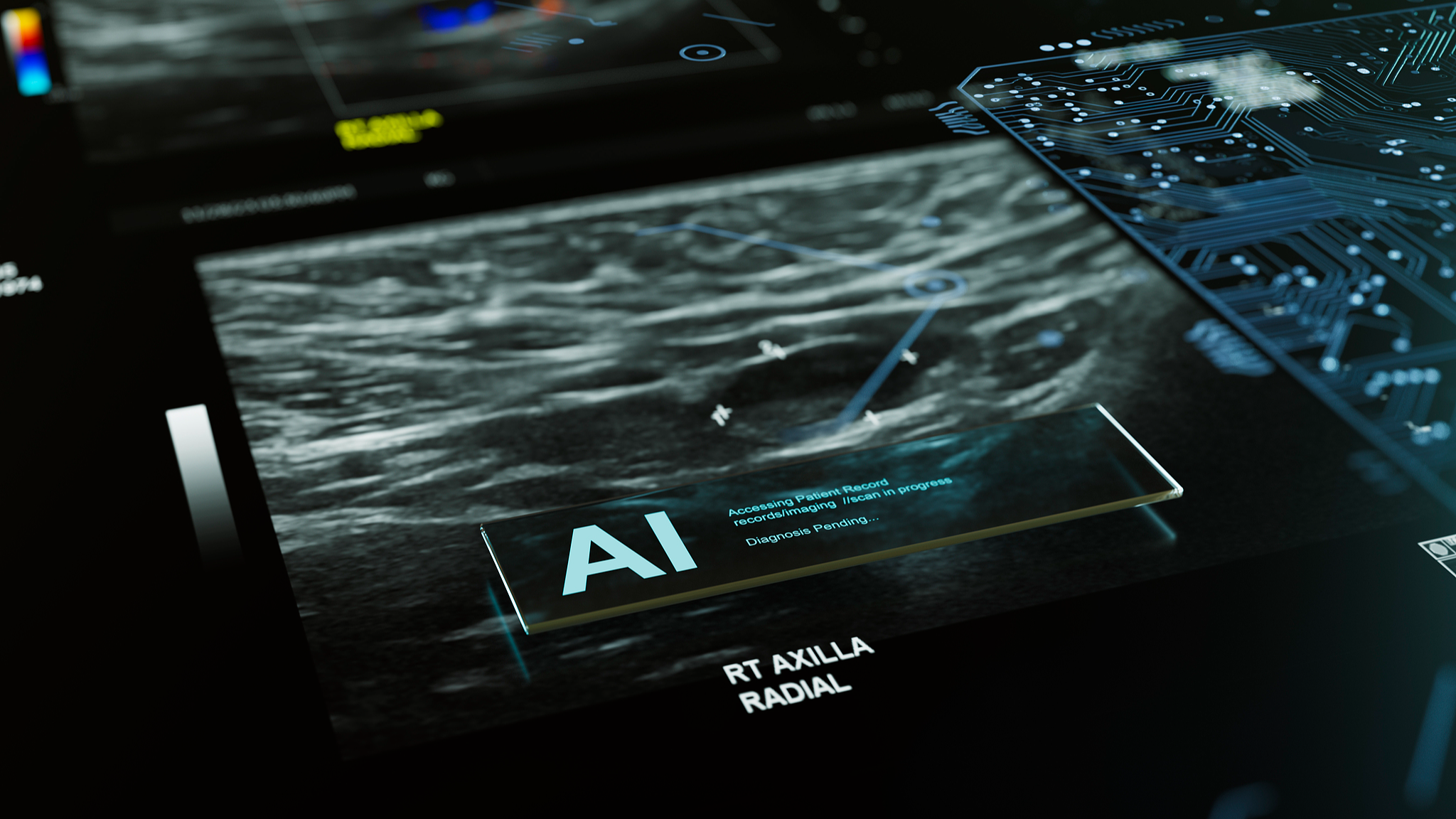 World-first trial: AI helps doctors spot breast cancer in scans