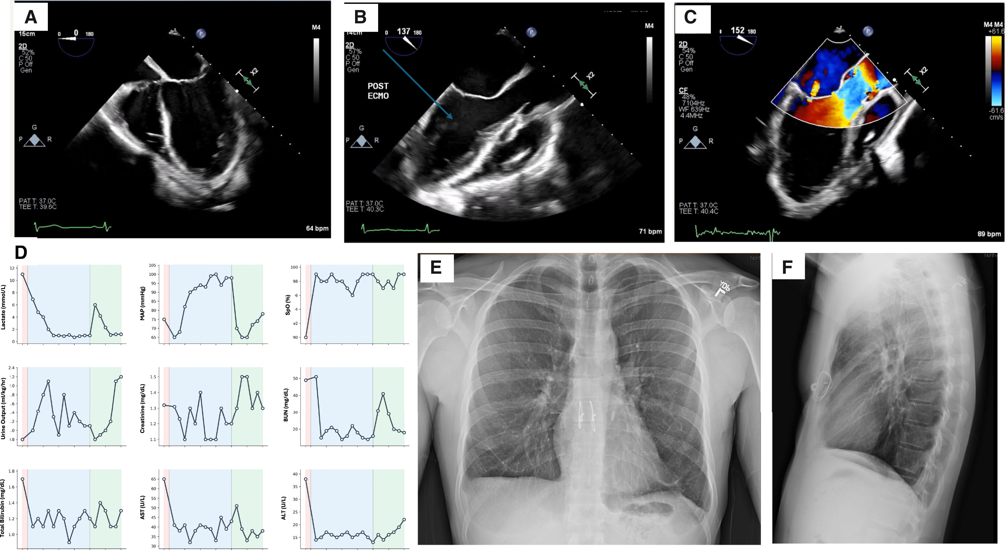 A map of the TAL circuit that provides oxygen and stabilizes heart pressure during the 48-hour gap. /Courtesy of Cell Press journal Med 