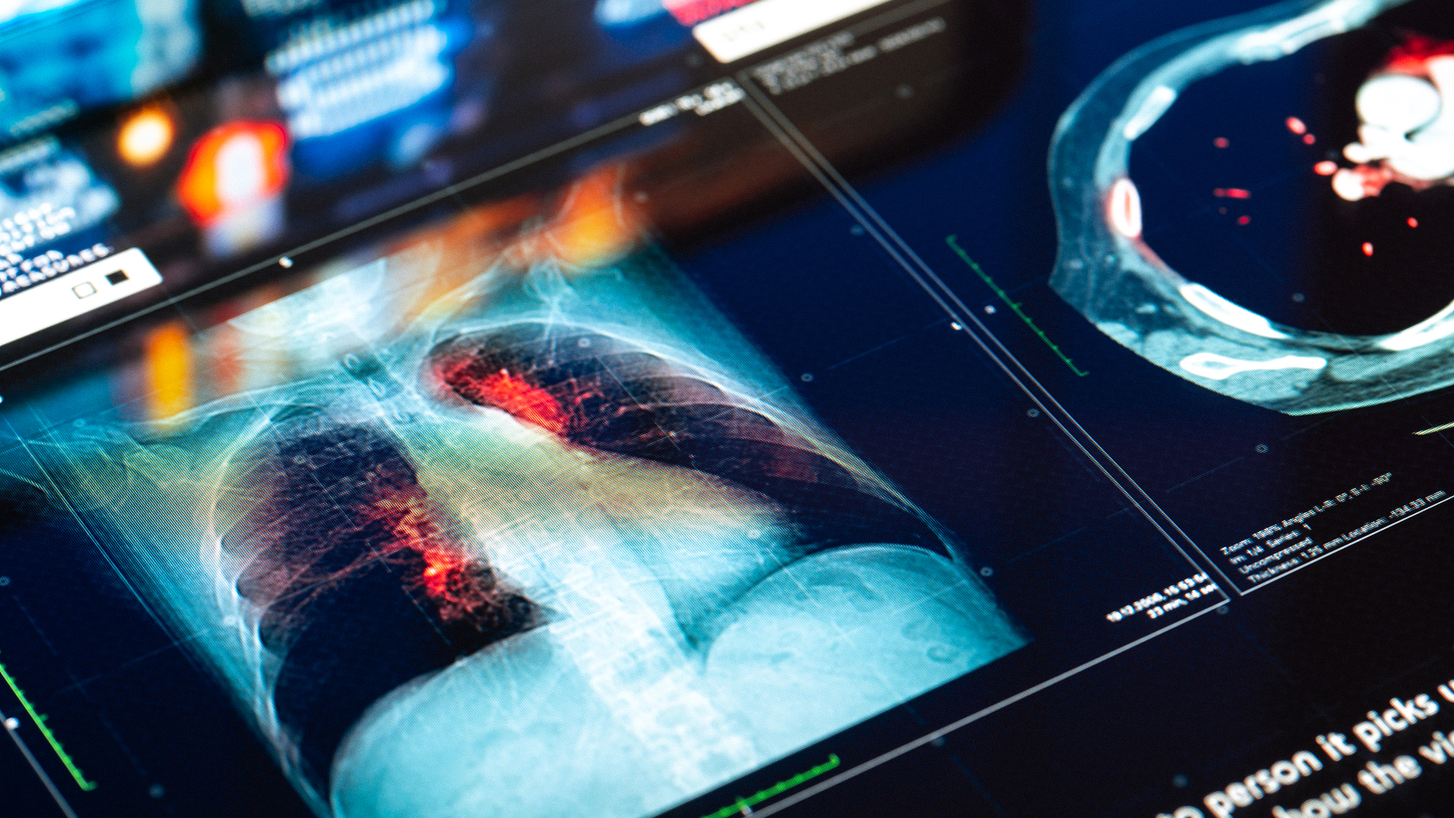 Medical MRI scan images showing the patient's chest condition. /CFP