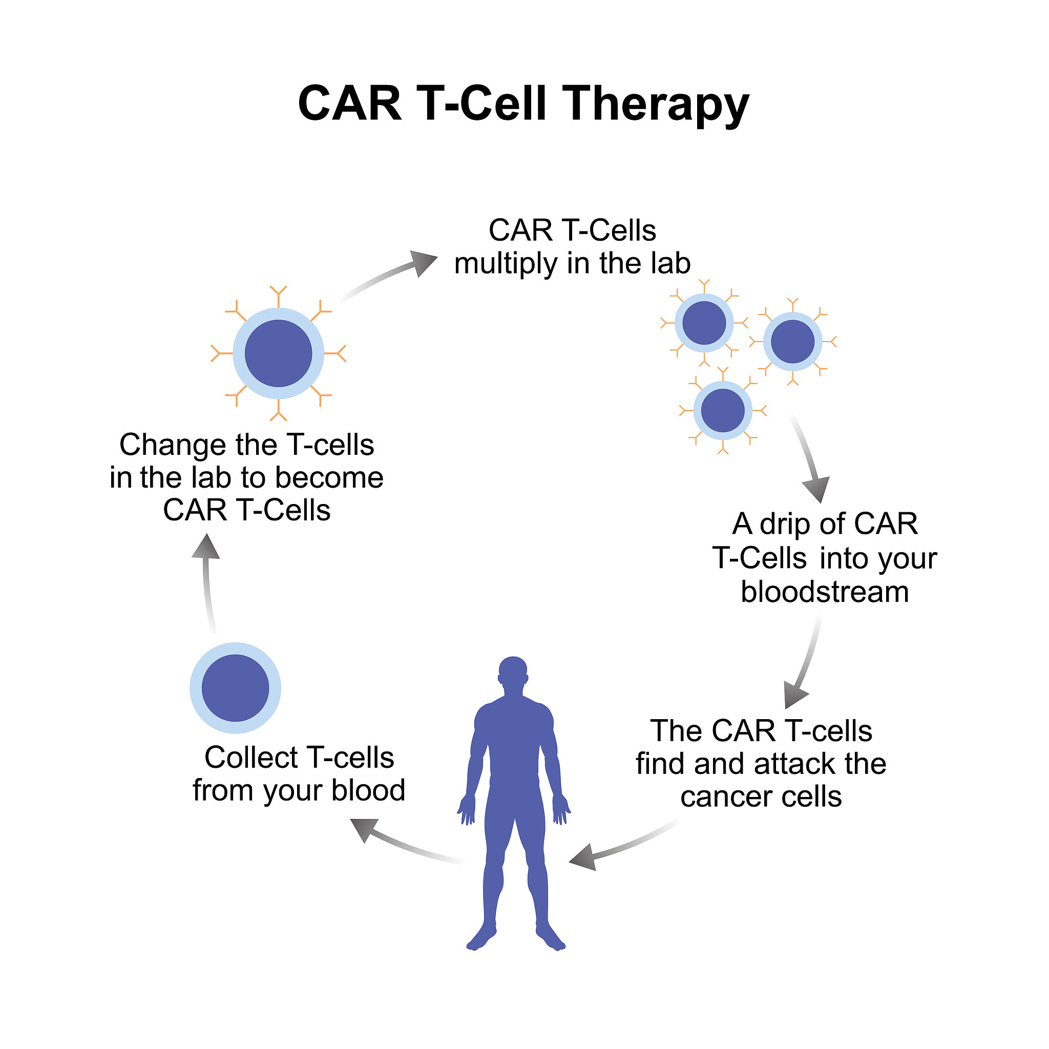 An illustration of CAR-T cell therapy. /VCG