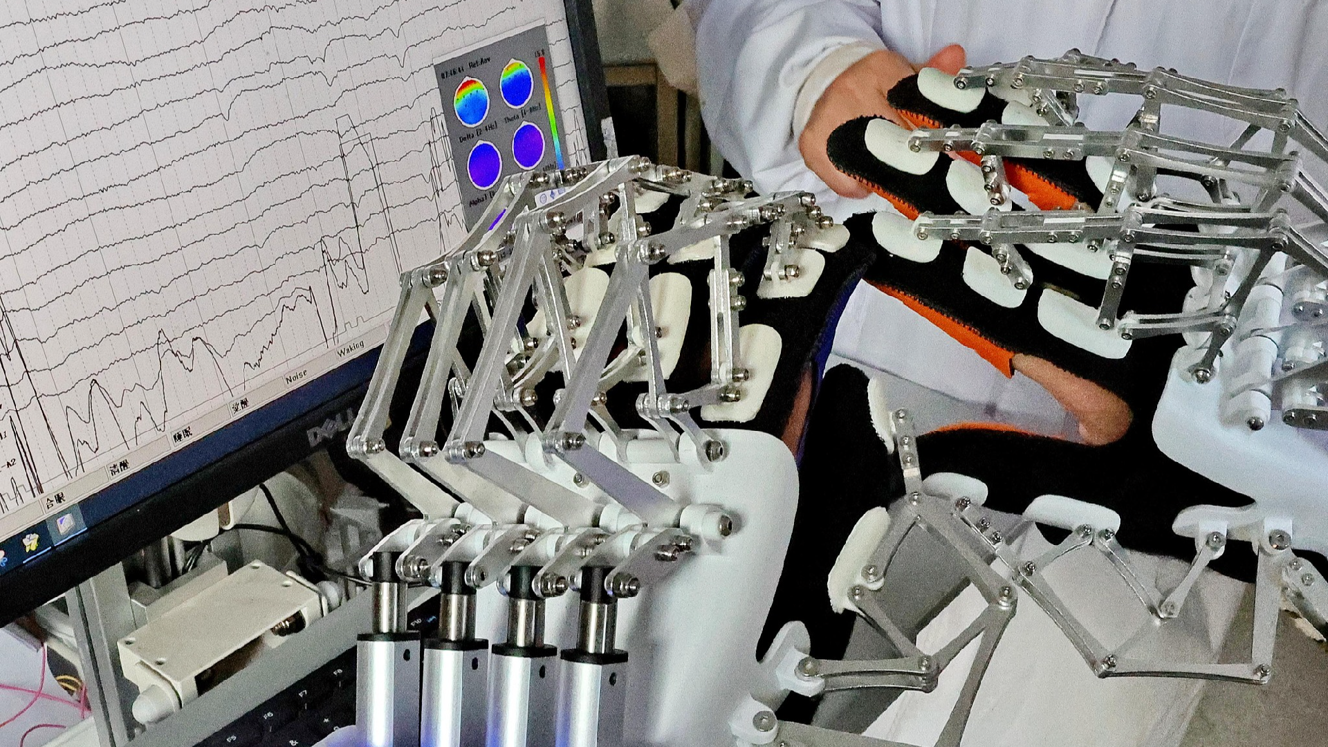 Is the brain-computer interface poised for takeoff in healthcare?