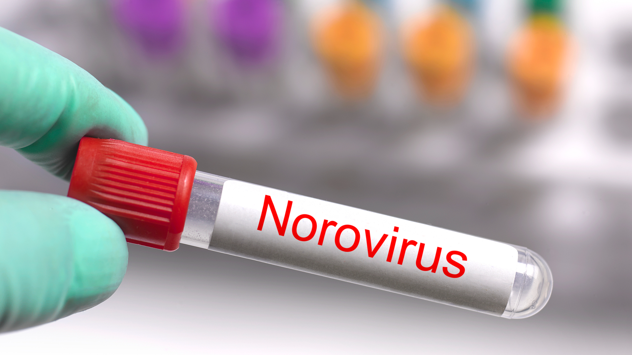 Norovirus surge in Japan spreads for fifth straight week