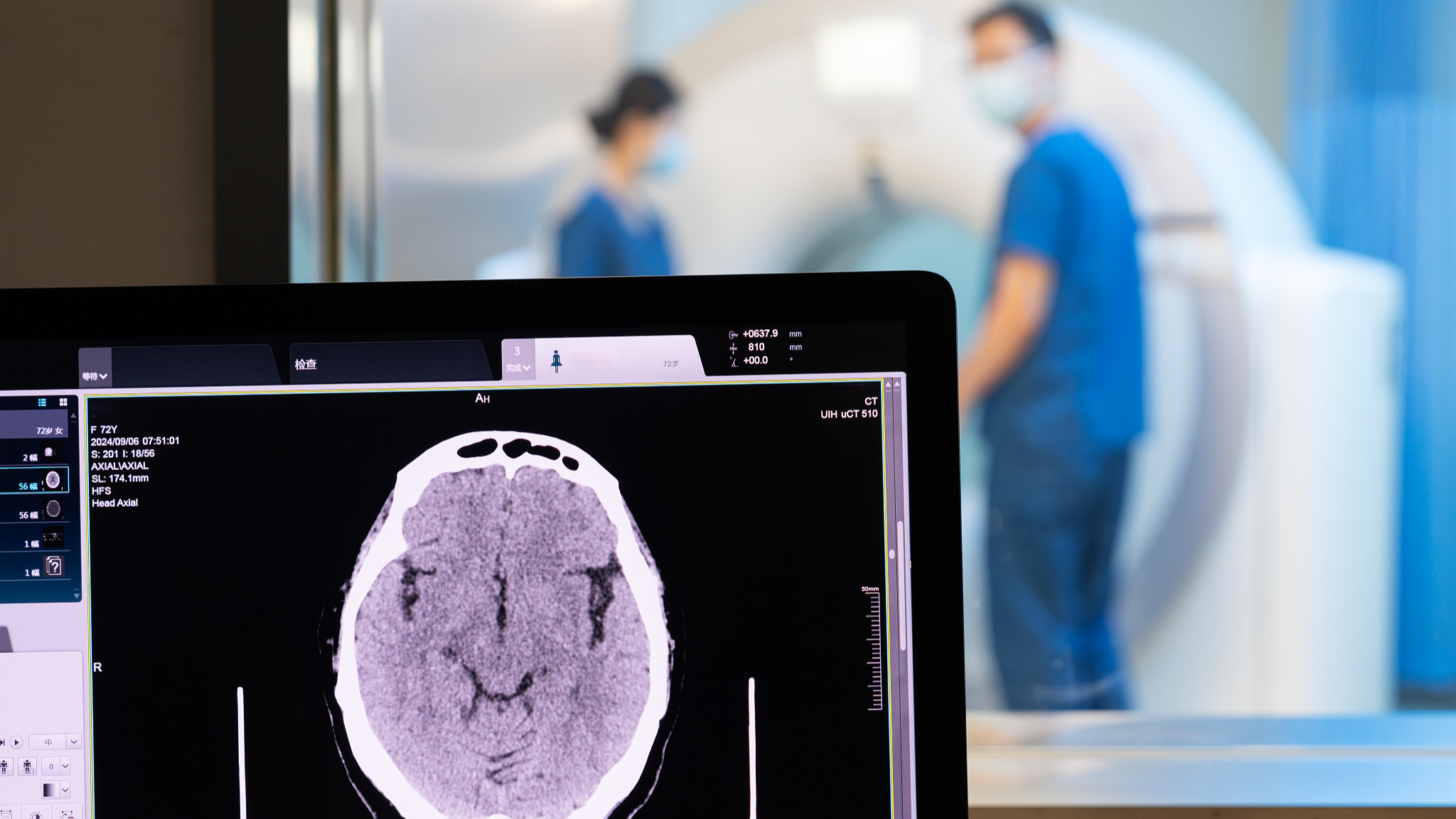 Better healthcare: China expands mutual recognition of medical tests