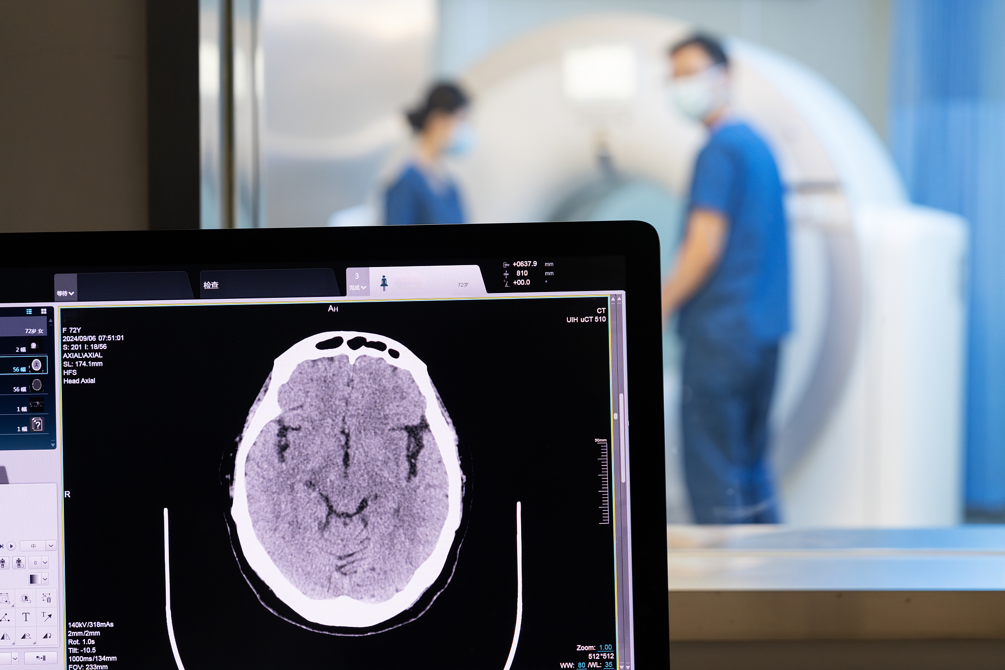 The results of a head computed tomography (CT) scan are displayed on a control room computer screen. /VCG