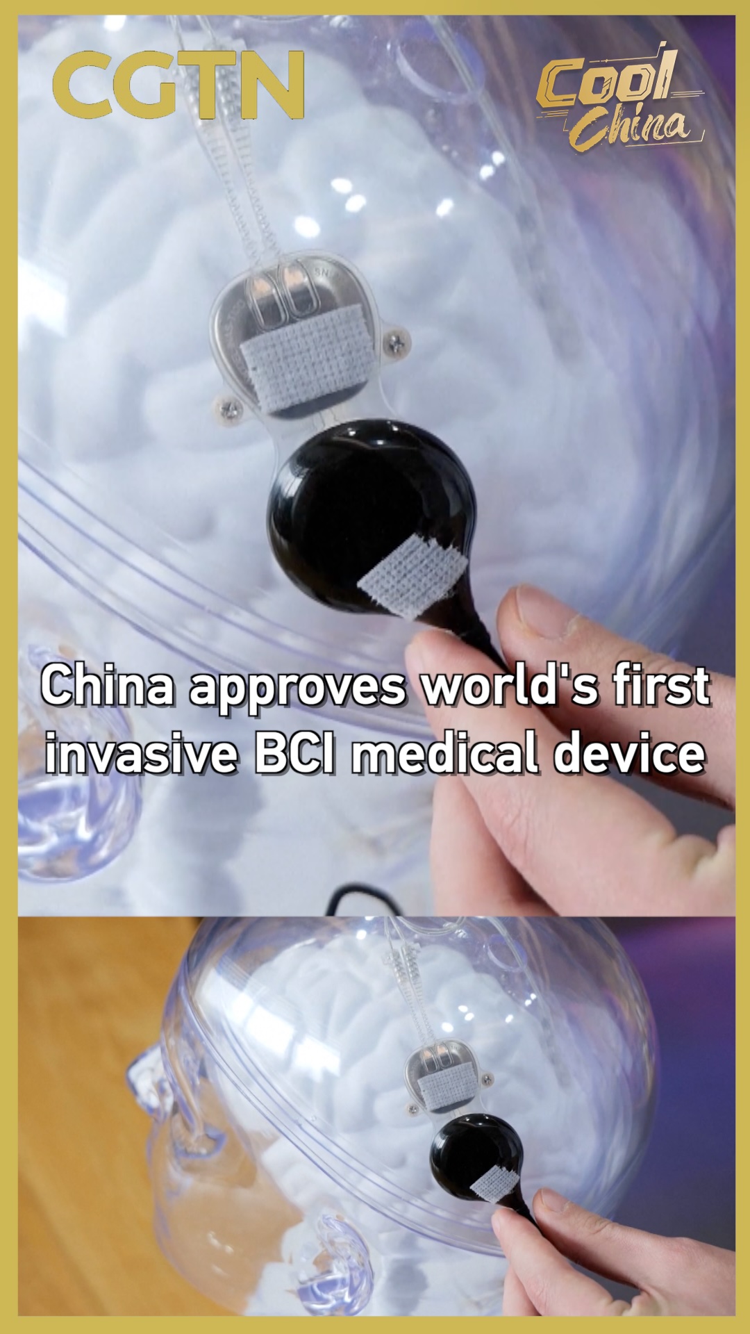 China approves world's first invasive BCI medical device