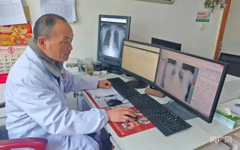 A radiologist reviews a patient's chest X-ray at a hospital in Nanjing, capital of east China's Jiangsu Province. /CMG