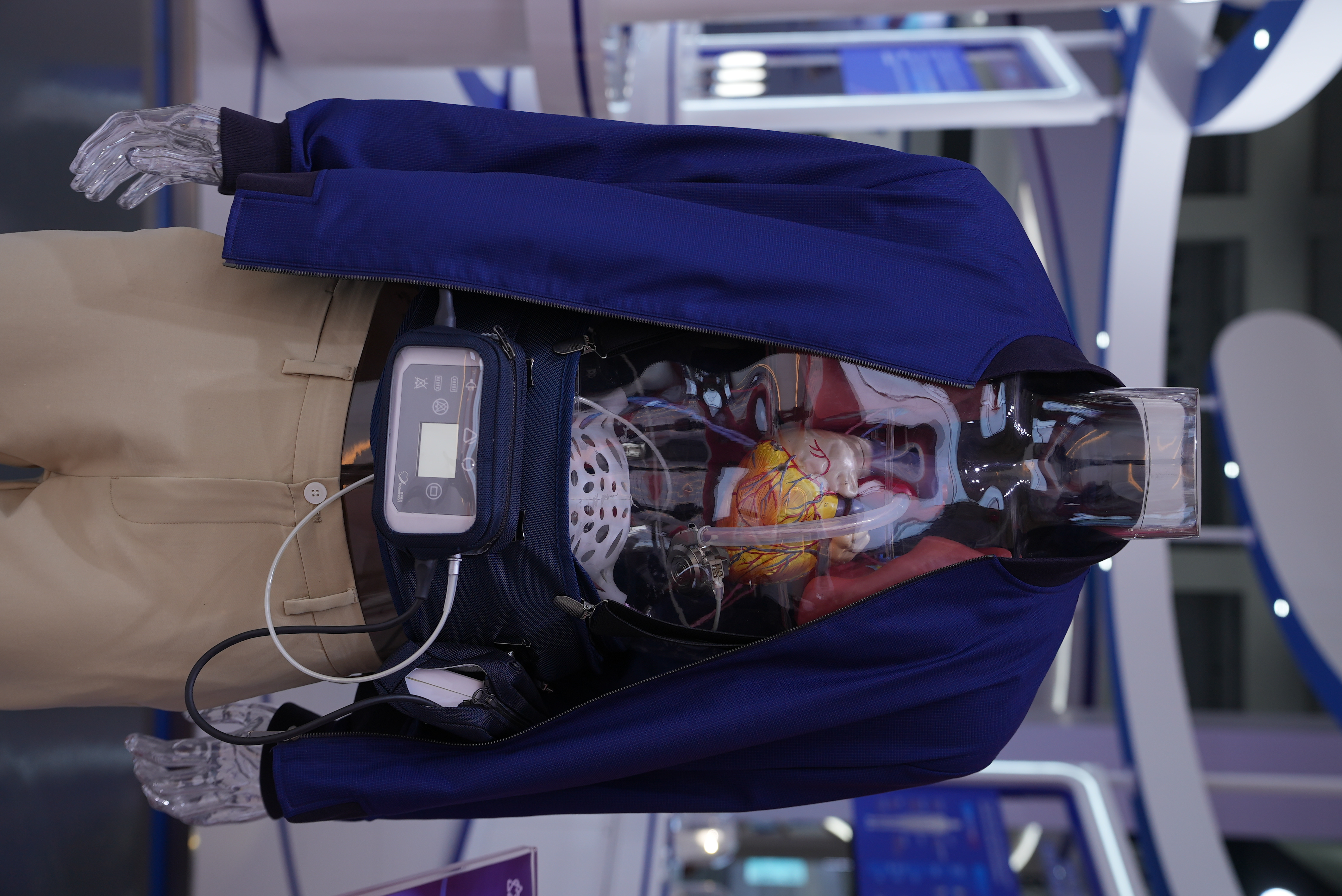 An implantable left ventricular assist system (VAD) is featured as a life-saving mechanical circulatory support for patients with heart failure, April 12, 2026. /CGTN