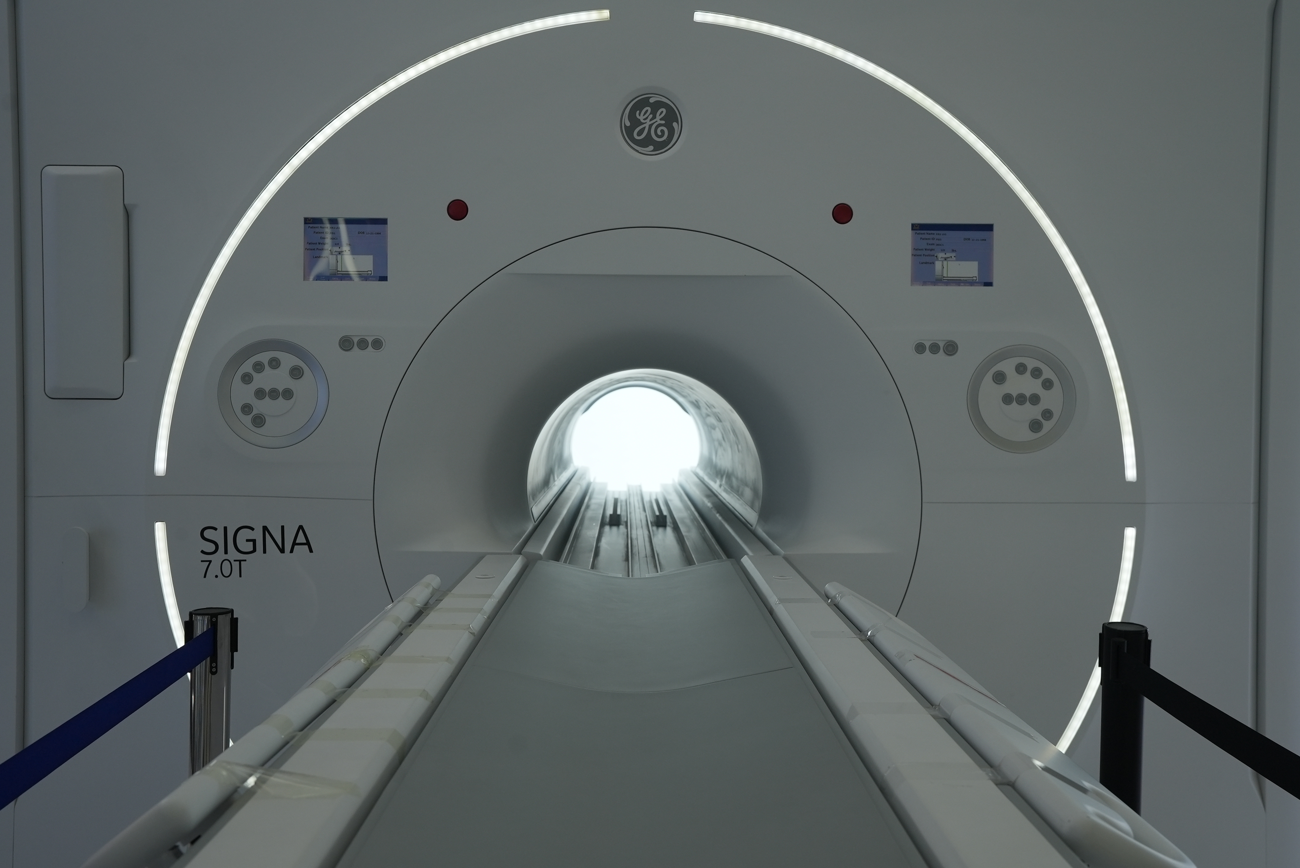 A 7.0T Magnetic Resonance Imaging (MRI) system provides ultra-high-field imaging capable of capturing neural activity finer than a strand of hair to help unlock the mysteries of neurodegenerative diseases. April 12, 2026. /CGTN