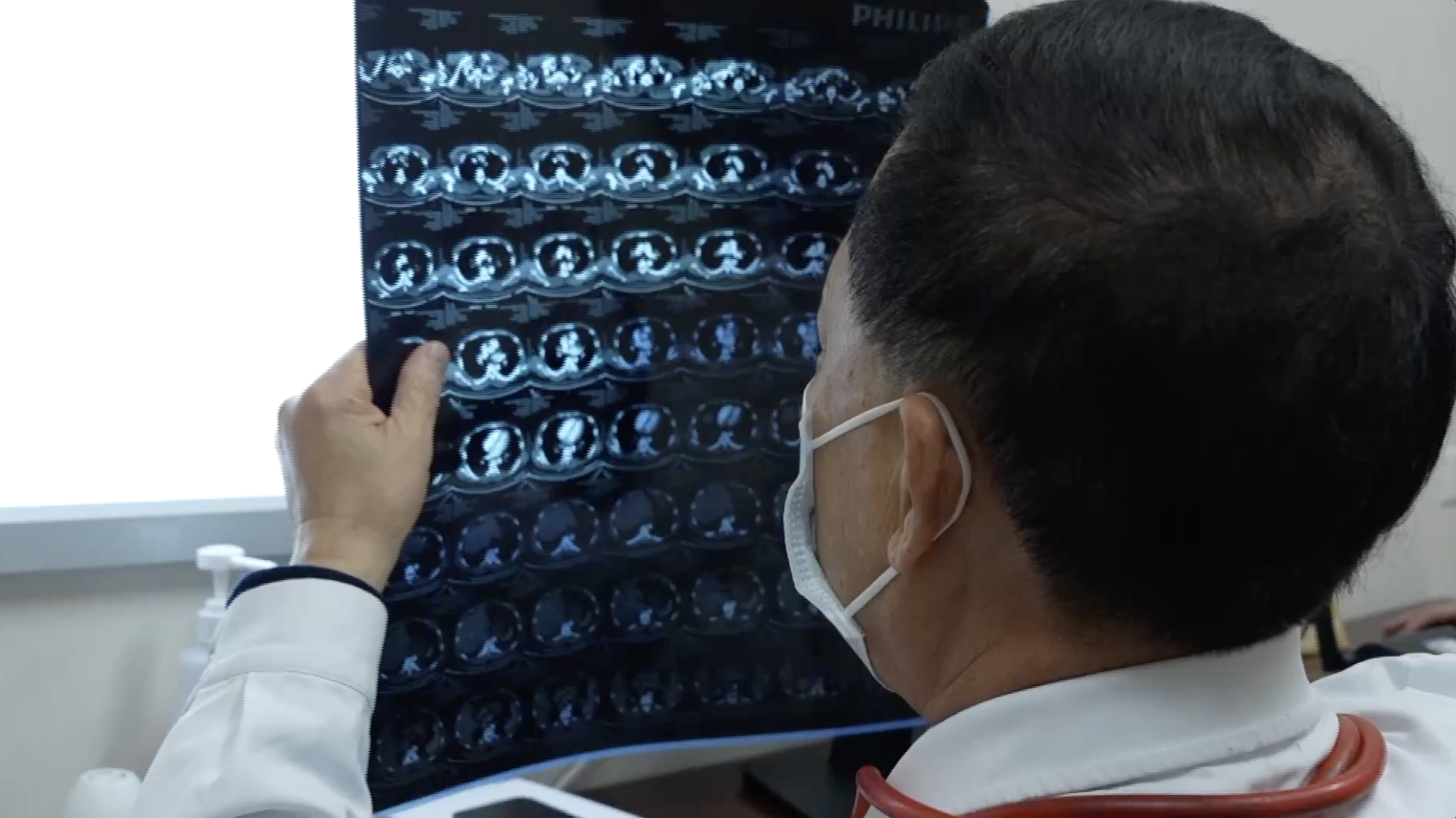 Professor Zhou reviews a patient's lung scans. /CGTN