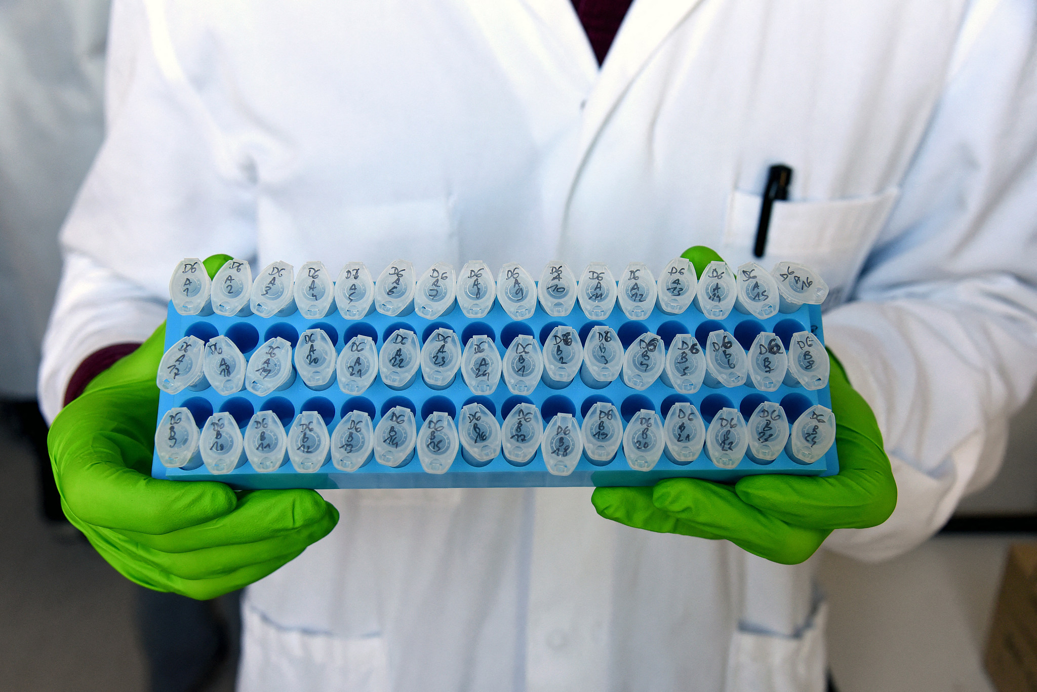Researchers study the intestinal microbiota in the development of certain cancers, particularly colorectal cancer in young adults, at Pasteur Institute in Paris, France, September 18, 2025. /VCG