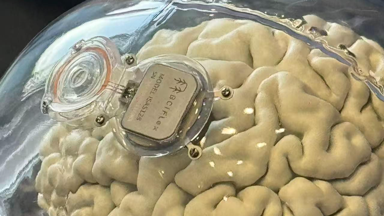 What is a brain-computer interface, and how does it work?
