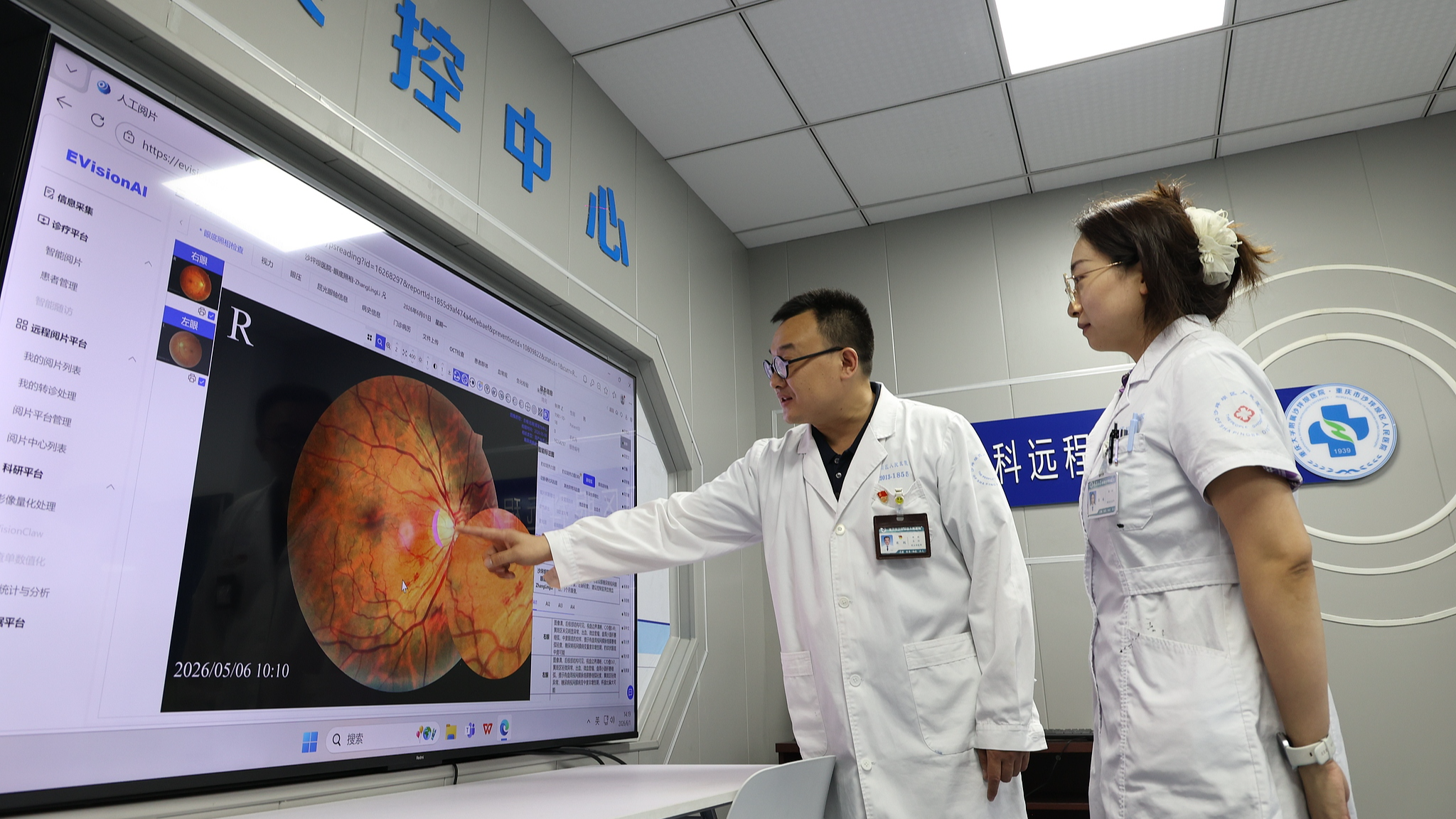 Doctors perform quantitative fundus analysis via a remote eye disease diagnosis platform at Shapingba Hospital Affiliated to Chongqing University, in Chongqing, southwest China, June 1, 2026. /VCG