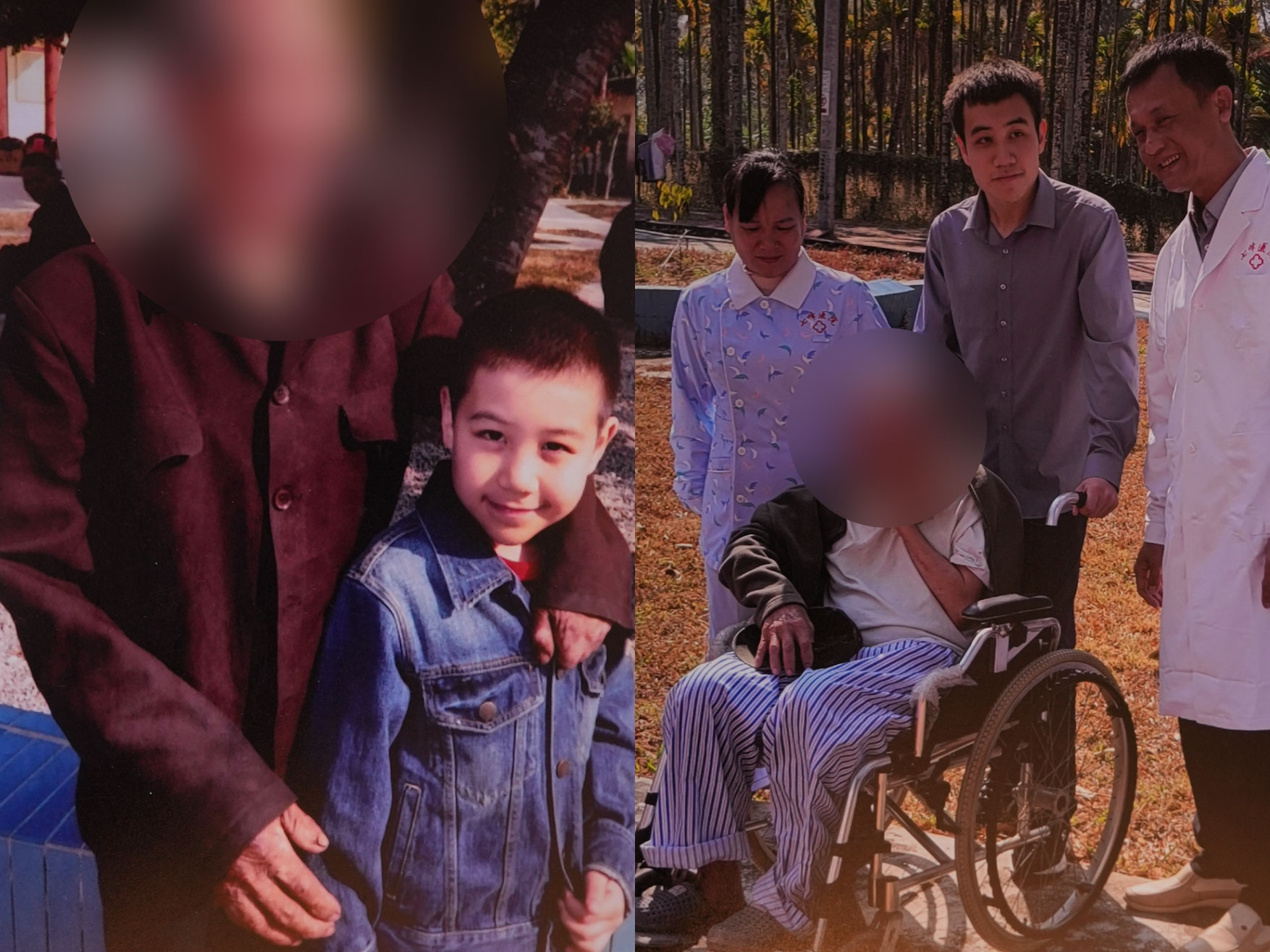 Ma Mingde, the great-grandson of Dr. Ma Haide, has been involved in leprosy prevention and treatment work since childhood. The left photo shows a young Ma Mingde with a leprosy patient, while the right photo shows him revisiting the same patient. /Courtesy of Zhou Youma