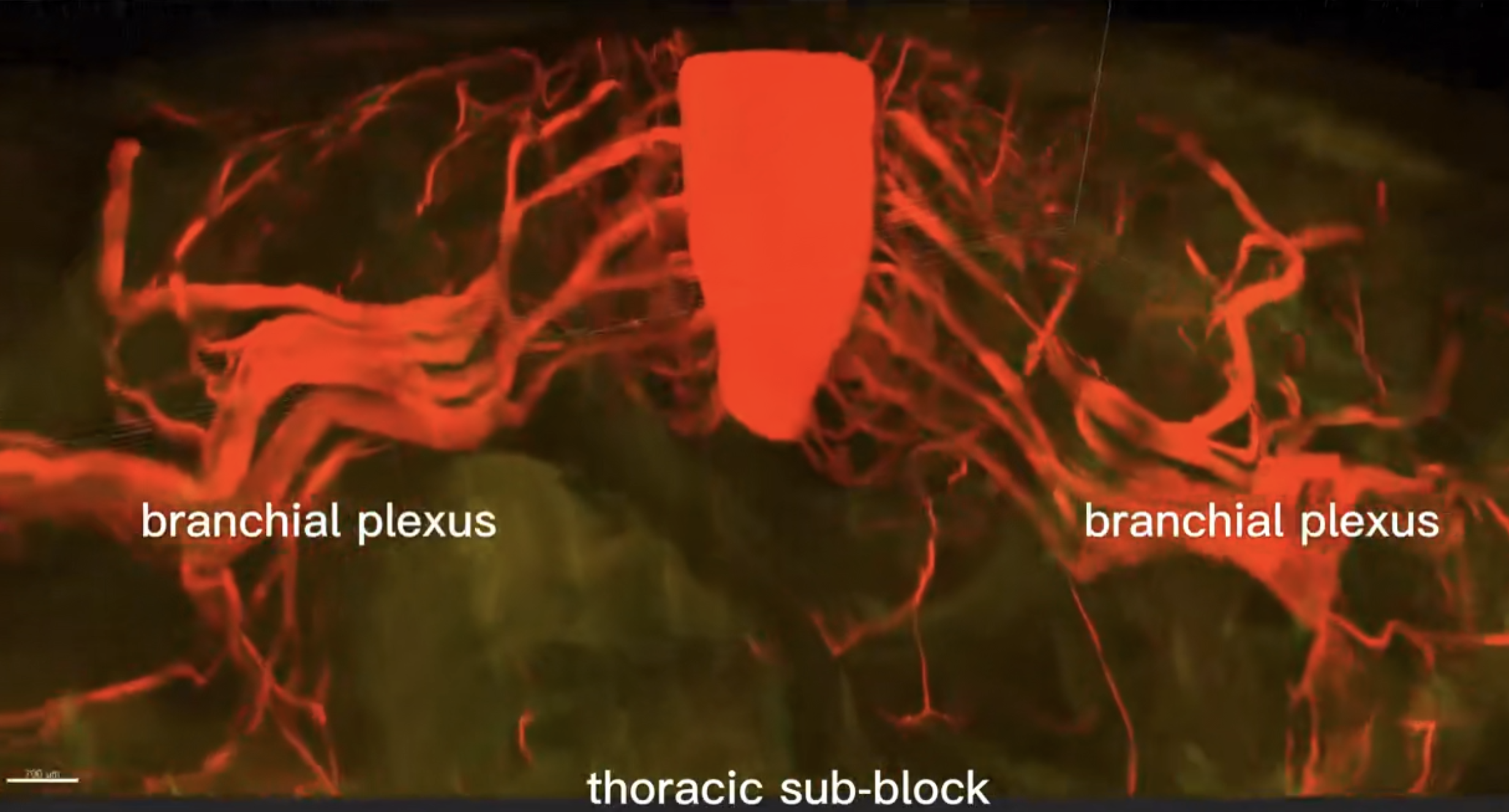 Whole-body neural reconstruction in a mouse using the TESOS method. /CIBR