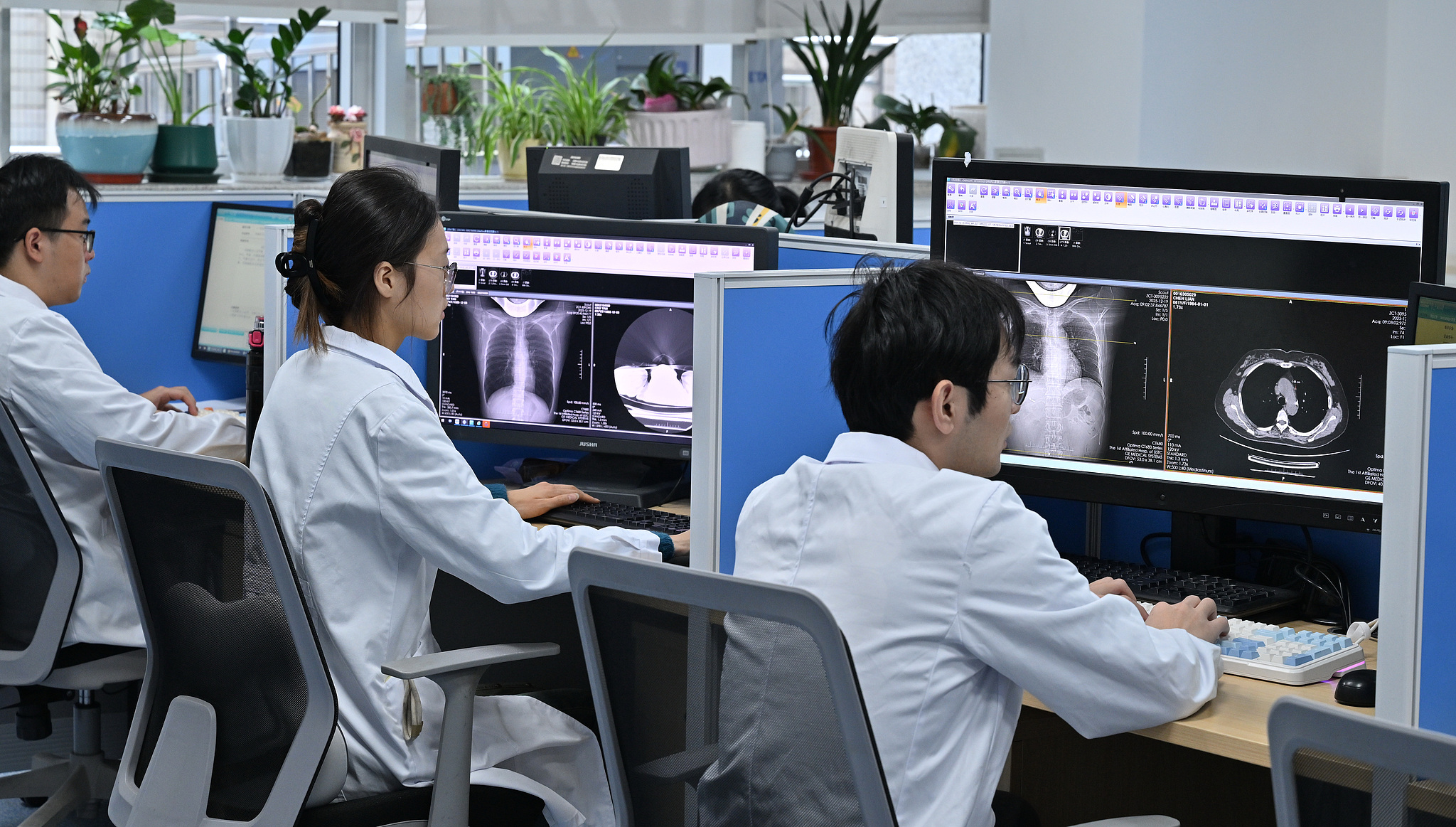 Radiologists review medical scans at a hospital of in Hefei, east China's Anhui Province, December 19, 2025. Powered by digital innovation, Anhui's imaging cloud platform links real-time diagnostic data across more than 2,300 medical institutions. /CFP