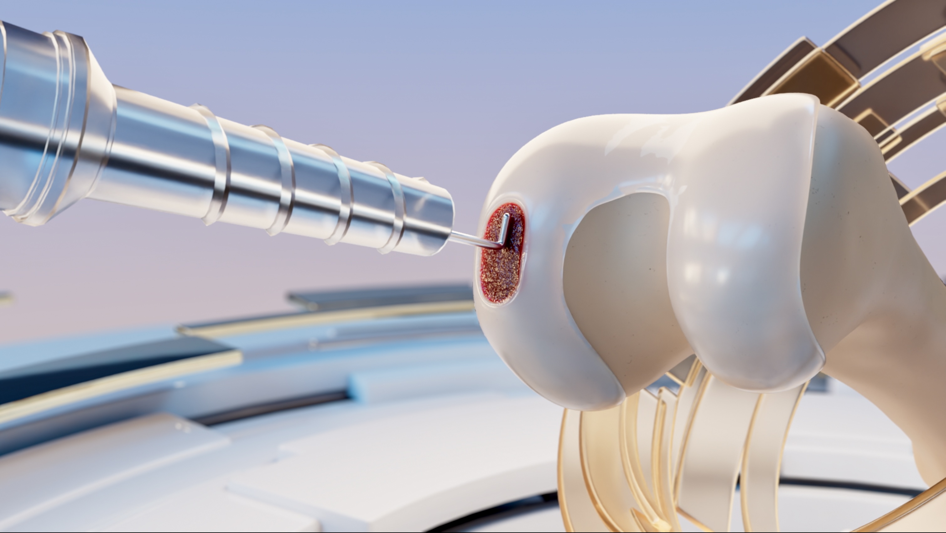 A computer-generated rendering of cartilage regeneration therapy. /CGTN