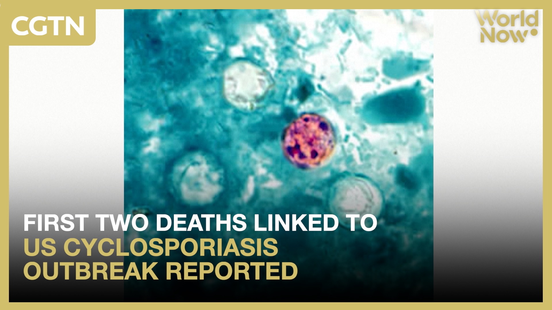 First two deaths linked to US  cyclosporiasis outbreak reported