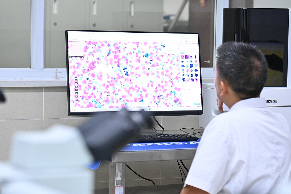 Medical staff review abnormal cells identified by an artificial intelligence system at the pathology department of Chongqing University Cancer Hospital, Chongqing, China, August 26, 2026. /VCG