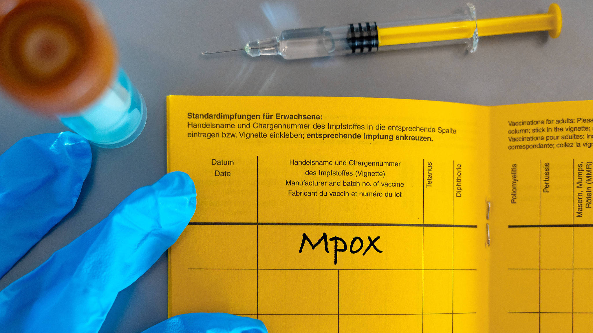 Russia investigates suspected monkeypox outbreak near Moscow